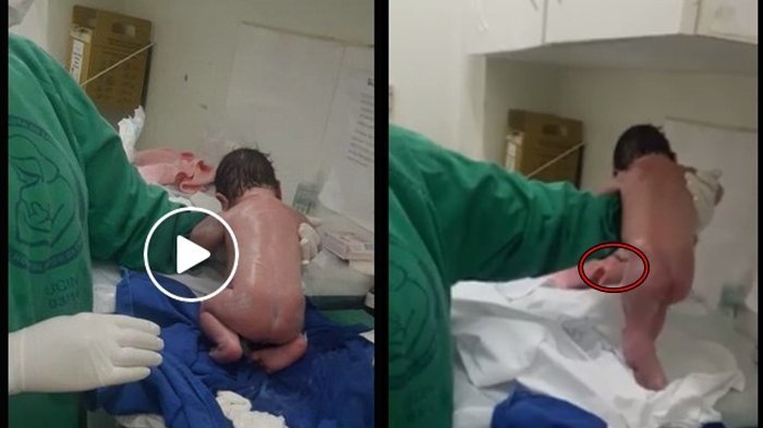 Viral Video Bayi Baru Lahir Meronta Ingin Berjalan