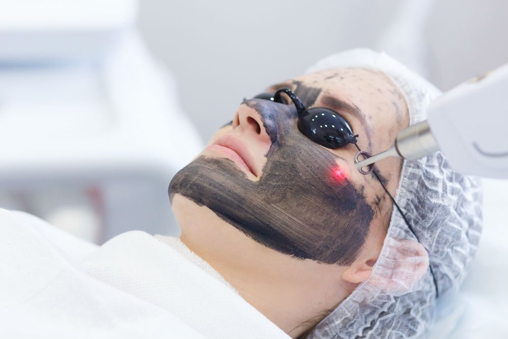Manfaat Treatment Laser Wajah